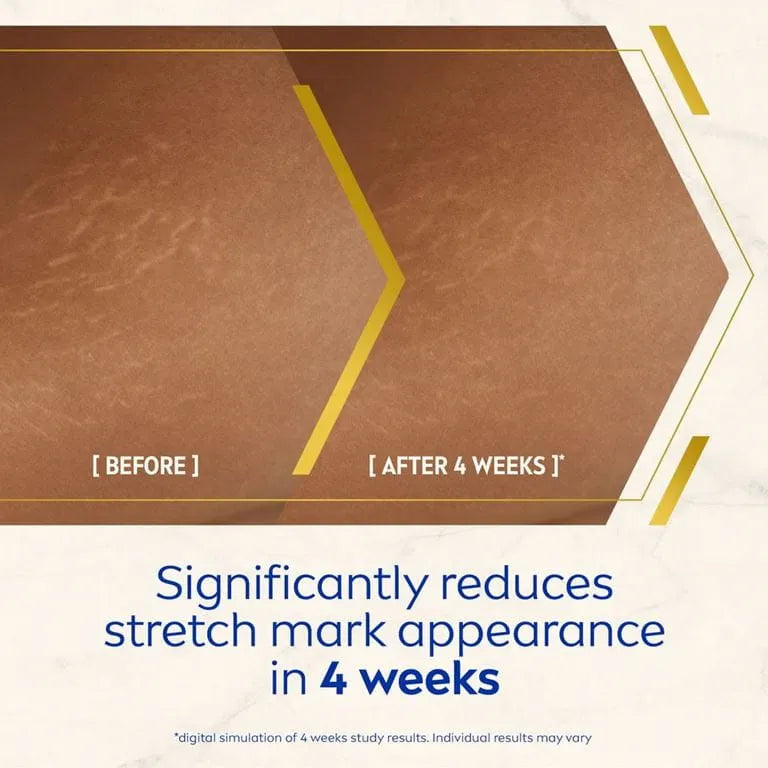 UUSI - Nivea Luminous360 Anti Stretch Marks -öljyseerumi